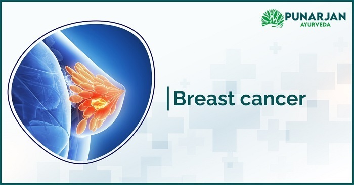 breast cancer symptoms and signs