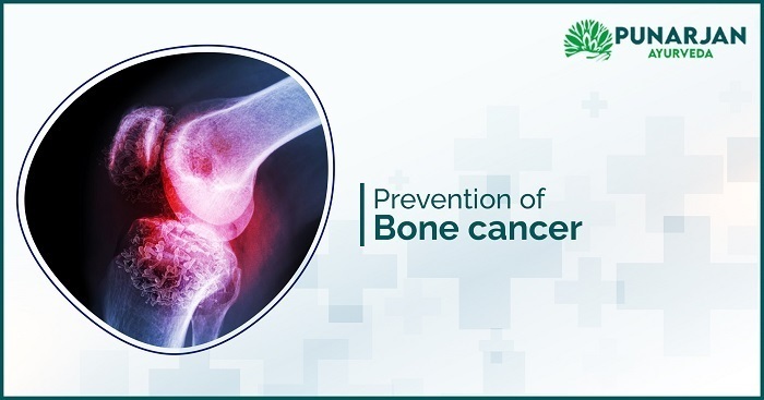 Prevent-Bone-Cancer