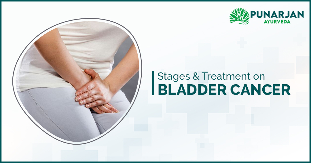 stages and treatment on bladder cancer