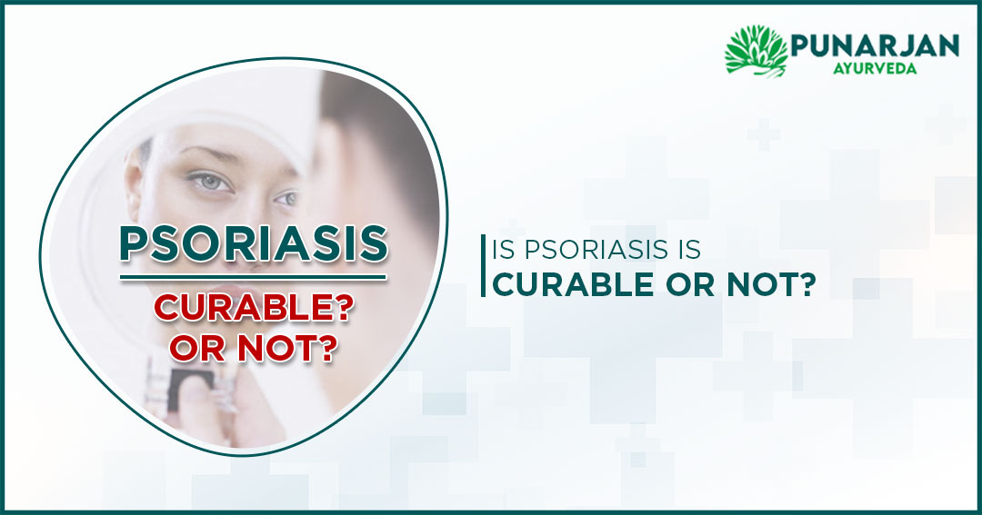 Psoriasis_is-curable-or-not