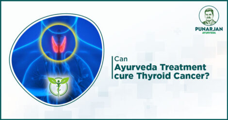 Can-Ayurveda-treatment-cure-thyroid-cancer