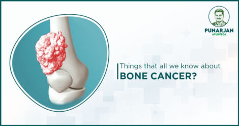 Things-that-all-we-know-about-Bone-Cancer