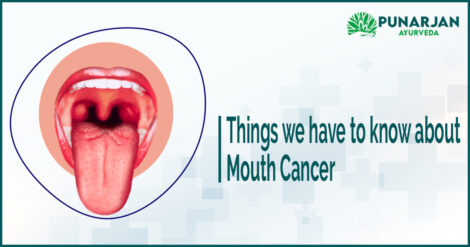 Mouth-cancer