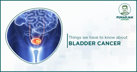 Bladder_Cancer_Treatment