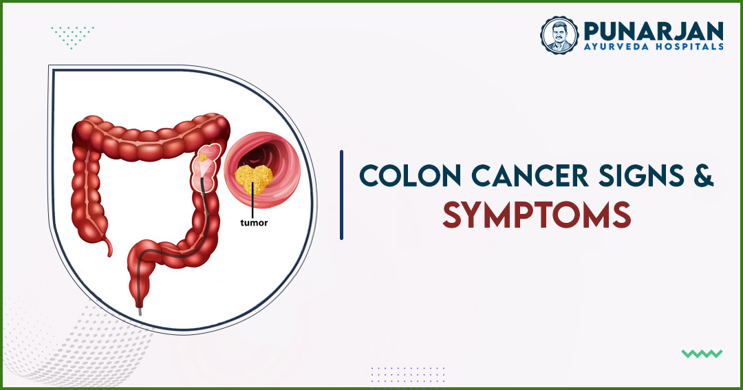 Symptoms of Colon Cancer