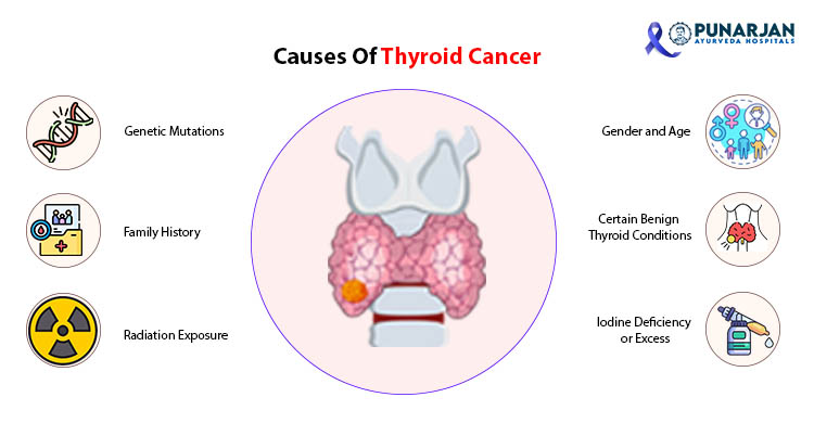 Causes Of Thyroid Cancer