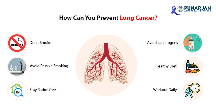 Prevention Of Lung Cancer