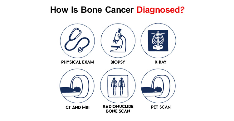 Bone Cancer Diagnose