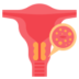 cervical-cancer