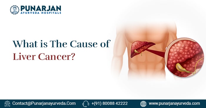 What are the causes of Liver Cancer