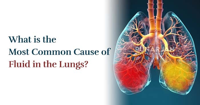 What-is-the-Most-Common-Cause-of-Fluid-in-the-Lungs