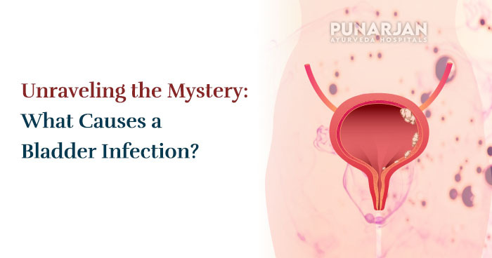 Unraveling-the-Mystery-What-Causes-a-Bladder-Infection