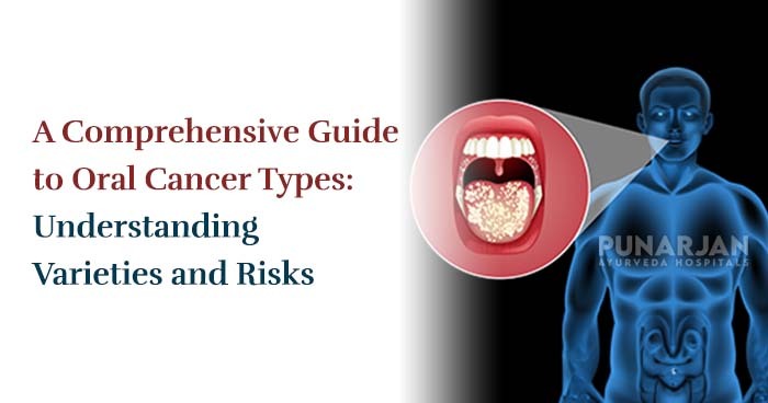 A Comprehensive Guide to Oral Cancer Types: Understanding Varieties and Risks