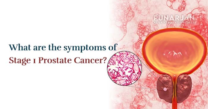What are the symptoms of stage 1 prostate cancer?