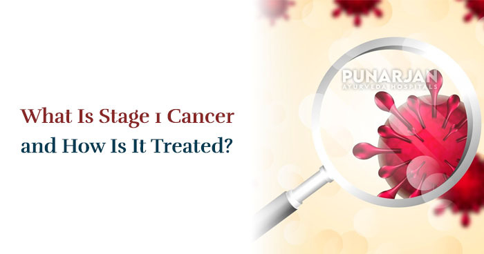 What Is Stage 1 Cancer and How Is It Treated?