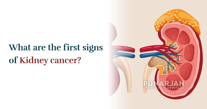 What are the first signs of kidney cancer?