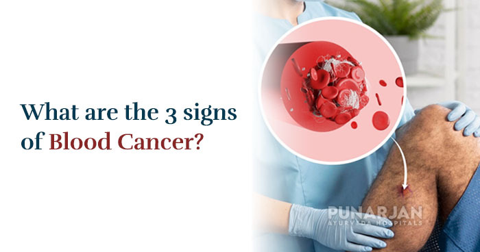 What are the 3 signs of blood cancer?