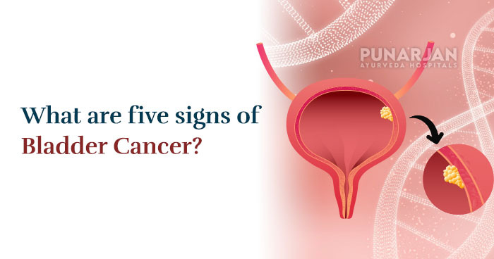 What are five signs of bladder cancer?