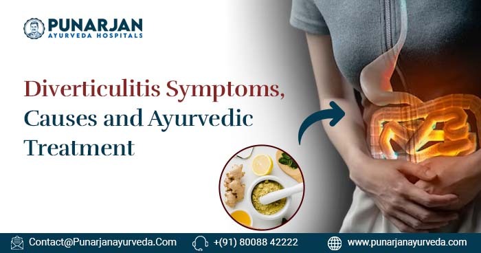 Diverticulitis Symptoms, Causes and Ayurvedic Treatment