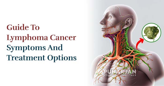Guide-To-Lymphoma-Cancer-Symptoms-And-Treatment-Options