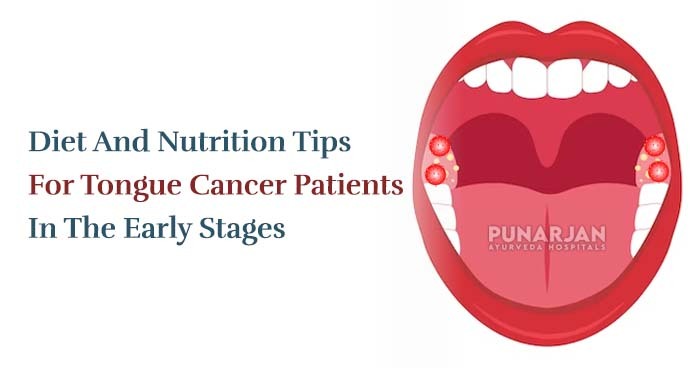 Diet And Nutrition Tips For Tongue Cancer Patients In The Early Stages