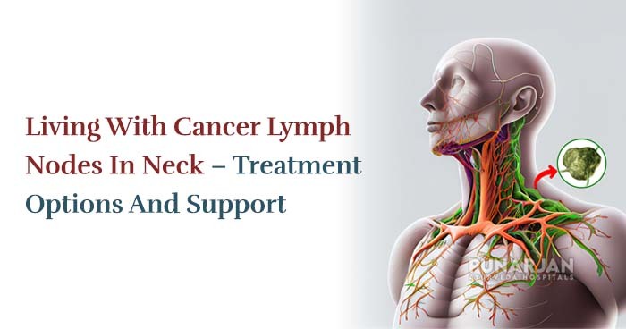 Living With Cancer Lymph Nodes In Neck – Treatment Options And Support