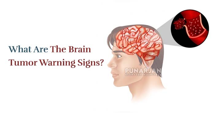 What Are The Brain Tumor Warning Signs