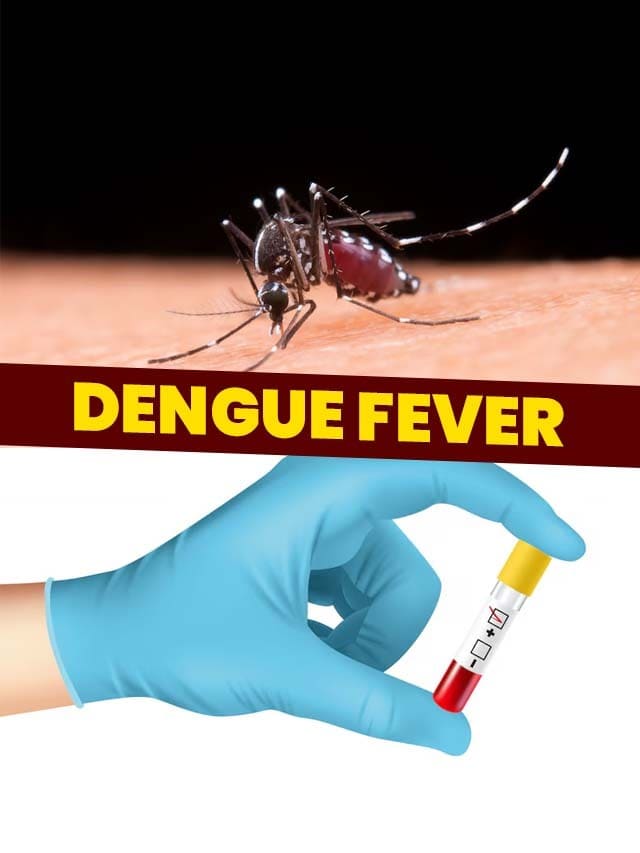 Boost Your Platelet Count: Essential Foods for Dengue Fever Recovery